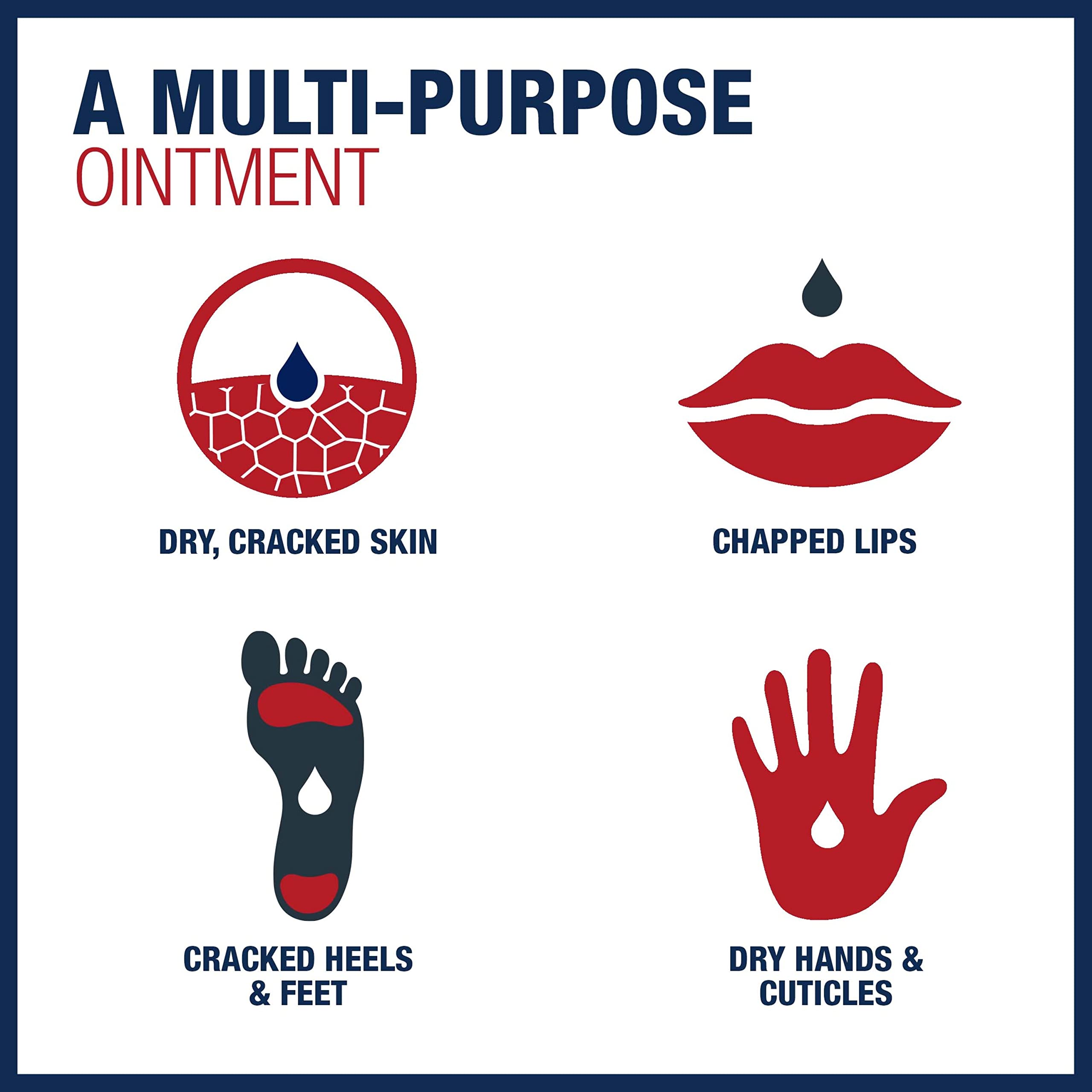 Aquaphor Advanced Therapy Healing Ointment, Hypoallergenic, Fragrance Free Body Moisturizer for Dry Skin and Minor Wound Care, Travel Size Skin Care Set for Holiday Gifts, 1.75 Oz Tube, Pack of 6