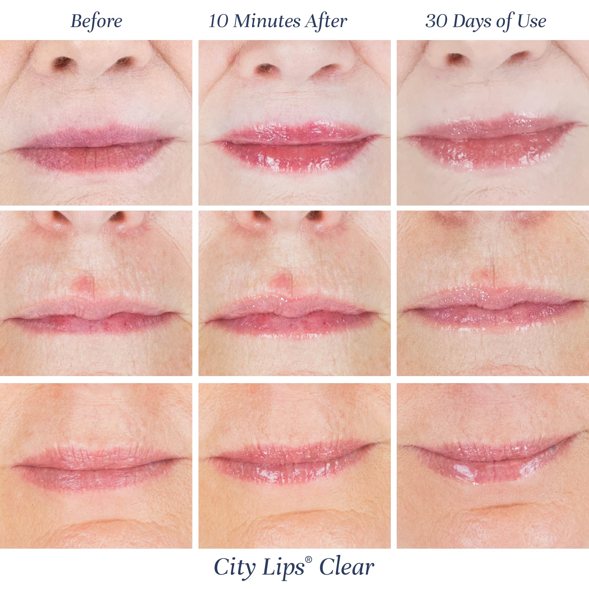 City Beauty City Lips Clear - Plumping Lip Gloss - Hydrate & Volumize - High Shine Lip Plumper - Hyaluronic Acid & Peptides Visibly Smooth Lip Wrinkles - Cruelty-Free (Clear, Pack of 1)