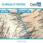 CeraVe Hydrating Anti Dandruff Conditioner, 0.5% Pyrithione Zinc Dandruff Treatment With Ceramides, Hyaluronic Acid & Niacinamide, Helps Eliminate Flakes & Reduce Itchy Scalp, Sulfate Free Conditioner